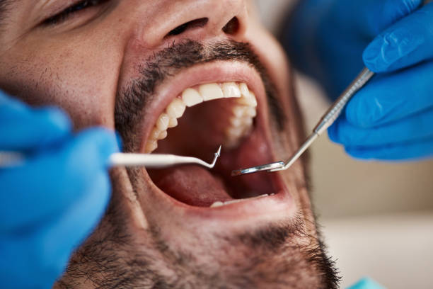 Best Dentist for Tooth Abscess  in Apple Valley, MN
